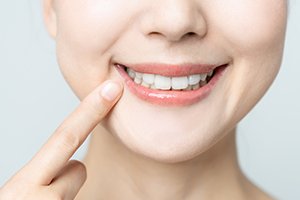 Woman pointing to healthy smile after periodontal therapy