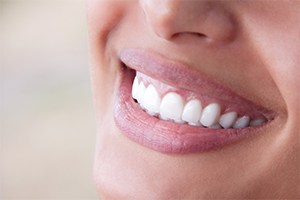 Person smiling after metal free dental restoration