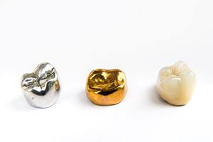 Dental crowns of different materials featured against white background