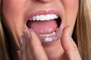 Closeup of patient placing Invisalign tray