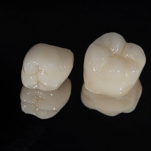 Three ceramic dental crowns on dark reflective surface