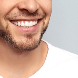 Close-up of man’s smile with beautiful metal-free restorations