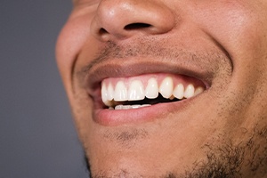 Man sharing smile after tooth colored filling restoration