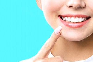 Woman pointing at her attractive smile with tooth-colored fillings