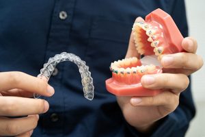 Dentist holding clear aligner and traditional braces model